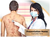 Chickenpox Editable PowerPoint Template