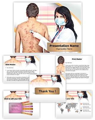 Chickenpox Editable PowerPoint Template