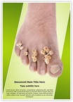 Foot mycosis Editable Template