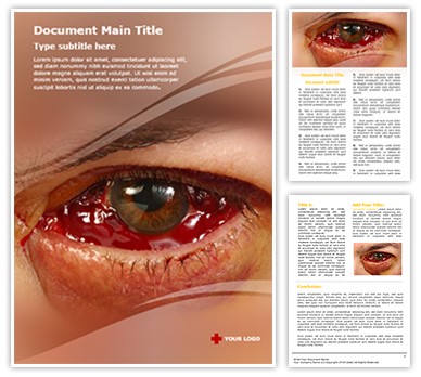 Rhegmatogenous Editable Word Template